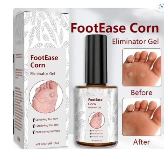 Feet Corn Removal Serum 30ml ( Pack Of 1 ) PRODUCT CODE(OS0008546)