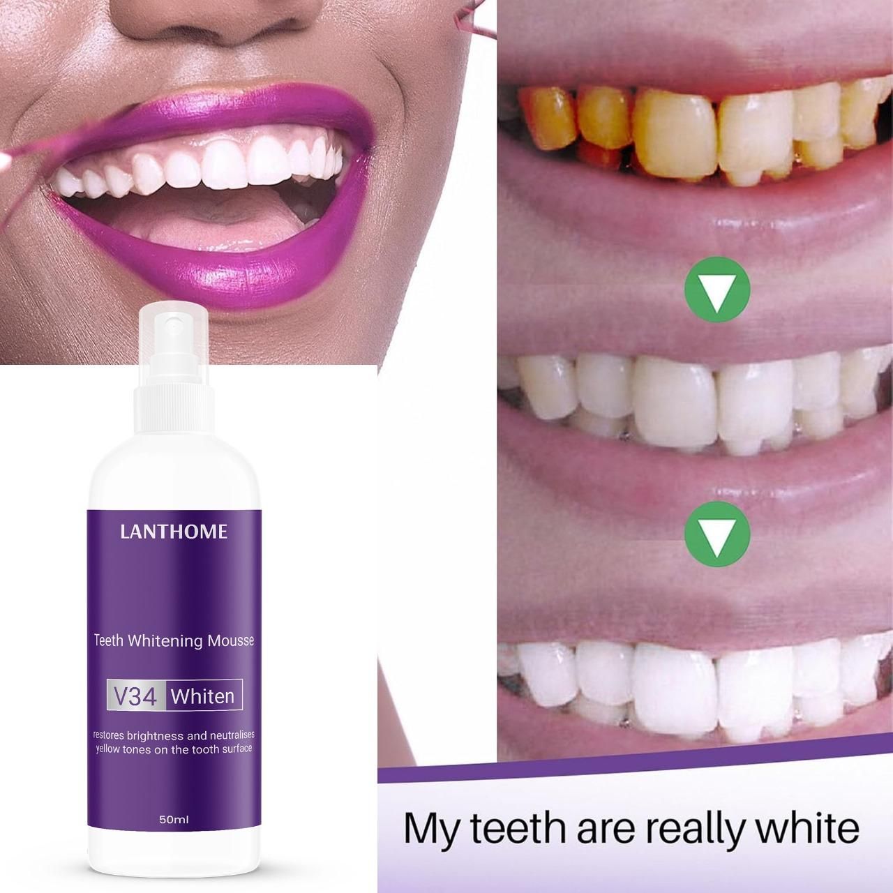 OS Lanthome Teeth Whitening Spray Mousse V34 Whiten 50ml (Pack Of 2) PRODUCT CODE (OS0001317)