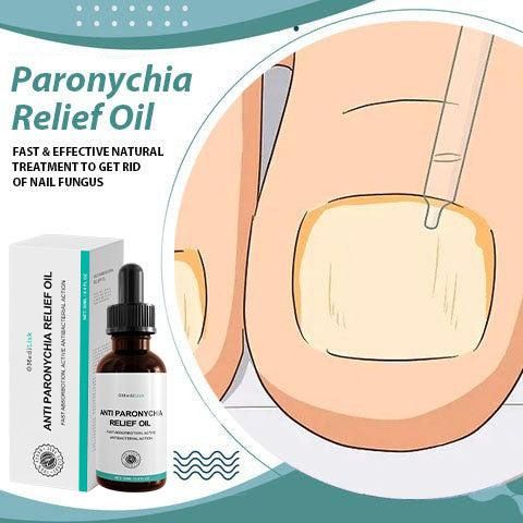 OS Anti Paronychia Nail Fungus Oil- 30 Ml PRODUCT CODE (OS0001266)