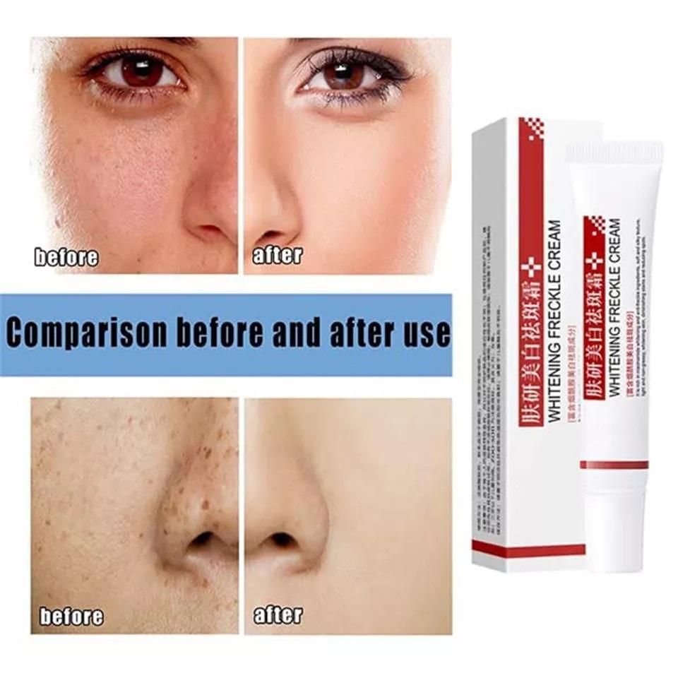 OS Effective Whitening Freckle Cream PRODUCT CODE (OS0001258)