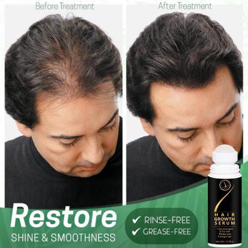 OS Hair Serum for Hair Growth Serum For Damaged & Dry Hair 45ml PRODUCT CODE (OS0001244)