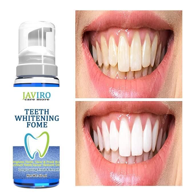 OS Teeth Whitening Fome (60 ML) PRODUCT CODE (OS0006003)