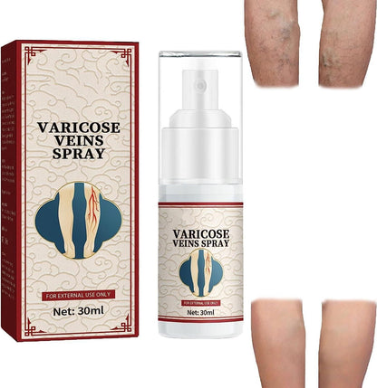 GMGVein Healing Varicose Veins Treatment Spray Pack of 2 PRODUCT CODE (GMG0006084)