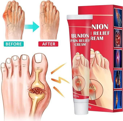 Bunion Pain Relief Cream (Pack Of 2)B PRODUCT CODE(OS0008569)