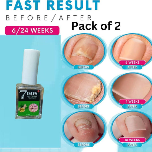 7 Days Nail Fungus Treatement Polish (Pack of 2)