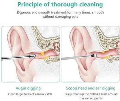 OS 6 Pieces Ear Wax Removal Smooth Stainless Steel Kit PRODUCT CODE(OS0002066)