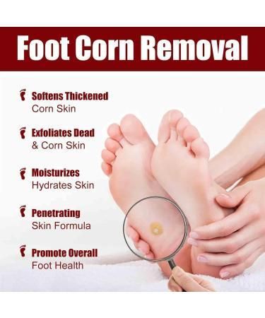 Feet Corn Removal Serum 30ml ( Pack Of 1 ) PRODUCT CODE(OS0008546)