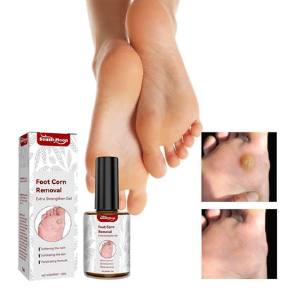 Feet Corn Removal Serum 30ml ( Pack Of 1 ) PRODUCT CODE(OS0008546)