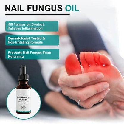 OS Anti Paronychia Nail Fungus Oil- 30 Ml PRODUCT CODE (OS0001266)