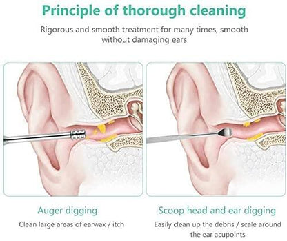 OS 6 Pieces Ear Wax Removal Smooth Stainless Steel Kit PRODUCT CODE(OS0002048)